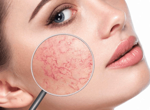 dermaglowcenterperosistratament